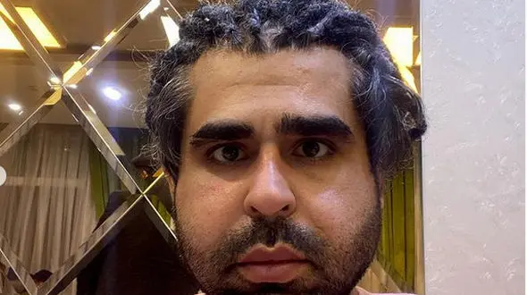 بازیگر مردایرانی: من پولدارم اما موهایم را چشم نزنید