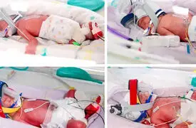 فیلم تولد یکی از نادرترین چهارقلوهای جهان در استرالیا؛ 4 دختر همسان و سالم به دنیا آمدند