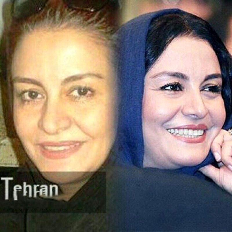 چهره بازیگران بدون آرایش از نرگس محمدی تا الناز شاکردوست.