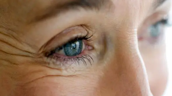 چطور جلوی پیری دور چشم را بگیریم؟