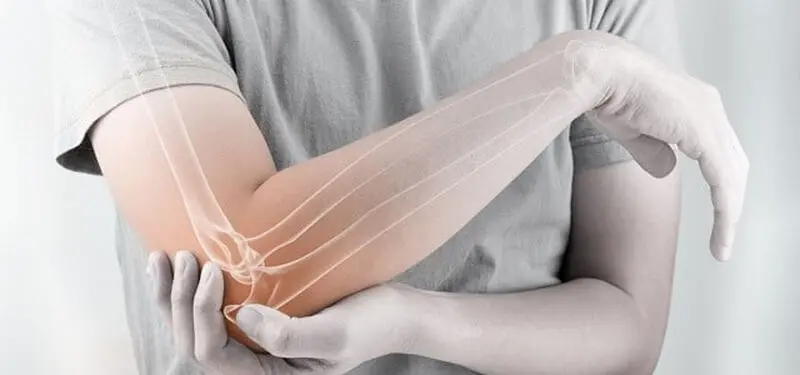 عکس روماتولوژی