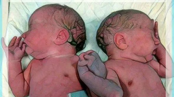 حمله مورچه ها به  نوزادهای دو قلو رها شده در کنار سطل زباله بیمارستان/در بندرعباس رخ داد + عکس نوزادها