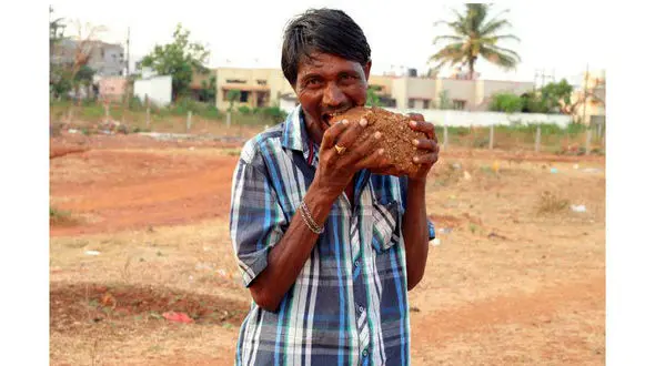 این مرد 30 ساله ناهار و شام آجر می خورد+عکس