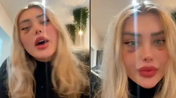 زن مو بلوند سرش در هواپیما بخاطر فشار هوا منفجر شد / وحشت در پرواز + عکس