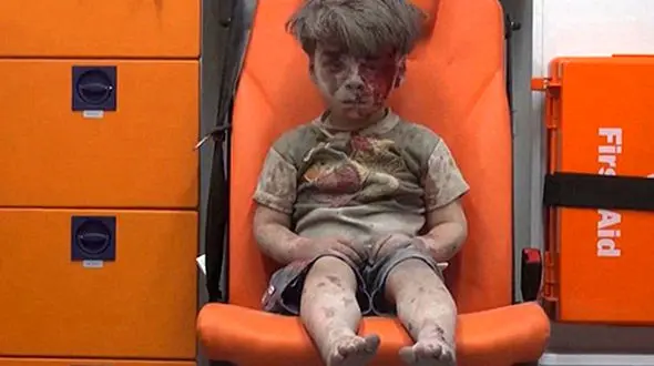 عکس تلخ از یک کودک که دل مردم جهان را شکست