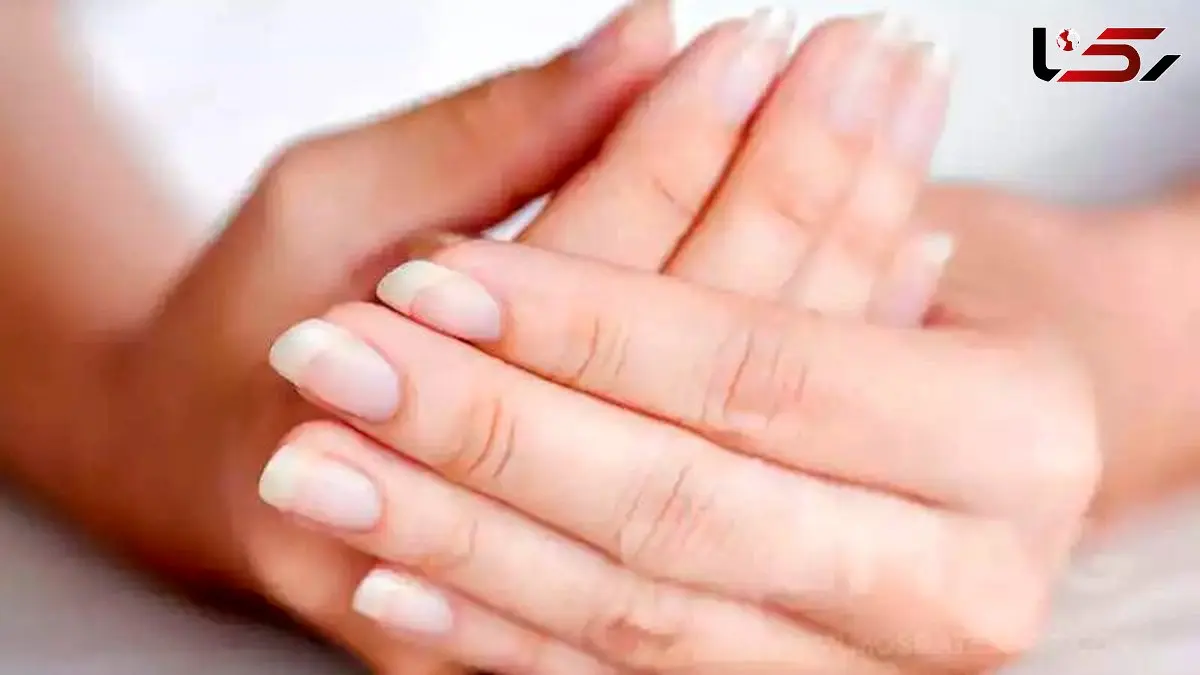 بیماری های ناخن: علائم، پیشگیری و درمان مؤثر