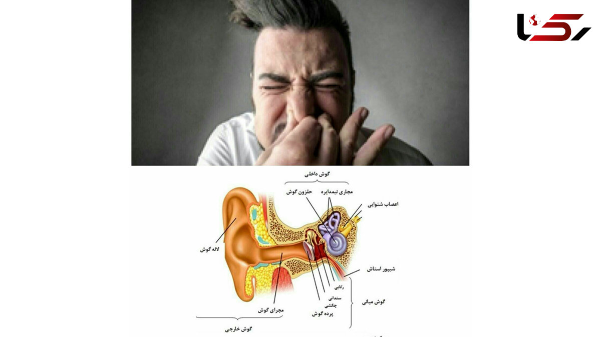 حبس عطسه قدغن!