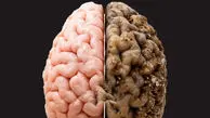 آیا شکر واقعا مغز را کوچک می‌ کند؟