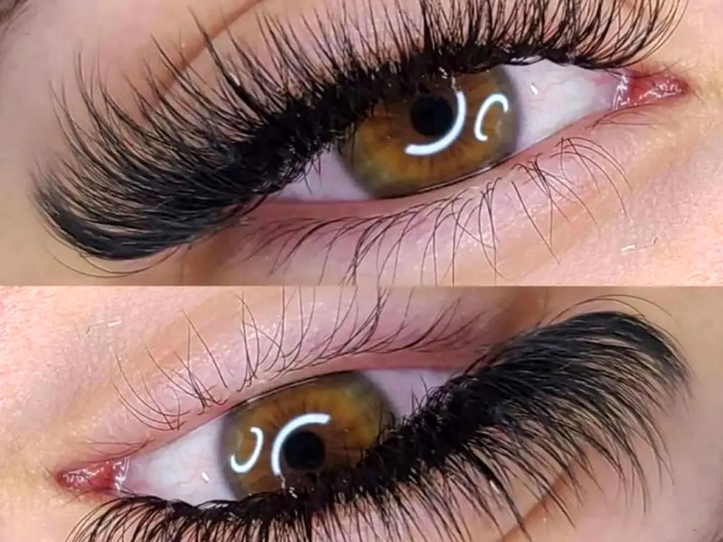 کاشت1