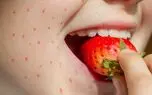 آیا به توت فرنگی حساسیت دارید؟ علائم رایج و راه‌ های پیشگیری
