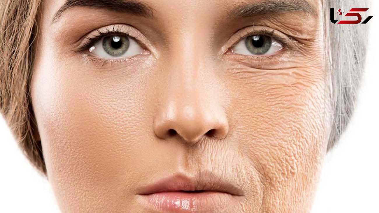 فرمول داشتن پوست خوب چیست؟