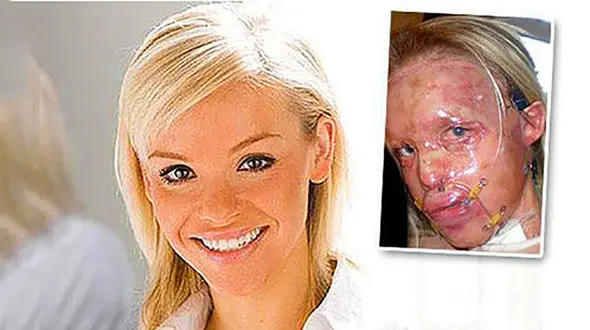 اسید پاشی به صورت مجری زن معروف + عکس