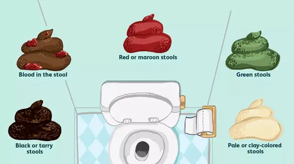 مدفوع سیاه نشانه چیست؟ / جدول علت و علائم مدفوع سیاه