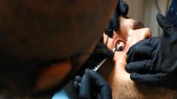 چندش ترین جراحی برای وحشتناک شدن قیافه به خاطر هواداران اینستاگرامی+تصاویر