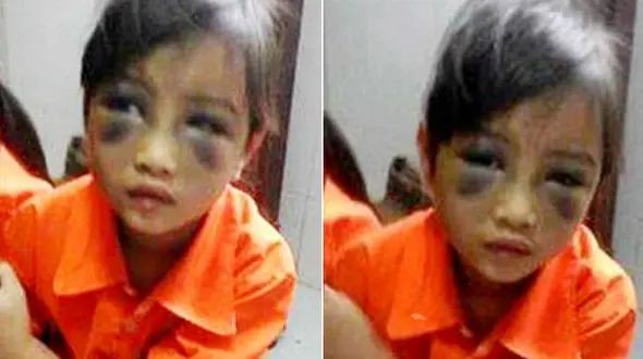 دستگیری معلم به خاطر تنبیه هولناک یک کودک + عکس