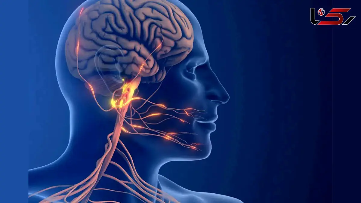 درک تازه‌ ای از دلایل میگرن، مسیر را برای هدف‌ های دارویی جدید باز می‌ کند