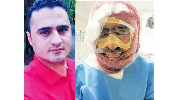 گره کور در اسید پاشی به مهندس کرجی /معمایی که 4 ماهه شد + عکس قبل و بعد از اسیدپاشی مرد جوان