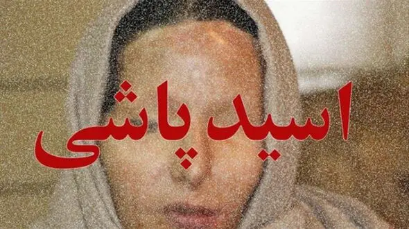 مجازات شوهر بدبین که به زنش اسیدپاشید تغییر کرد ! + جزئیات 