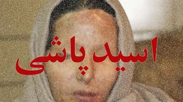 مجازات شوهر بدبین که به زنش اسیدپاشید تغییر کرد ! + جزئیات 