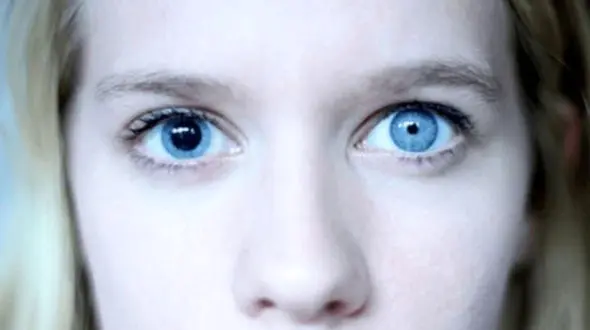 اختلال ژنتیکی این افراد را مشهور کرد + عکس