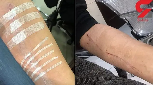 فیلم صحبت های زن ایرانی که مورد برخورد وحشیانه و نژادپرستانه گرجستانی ها