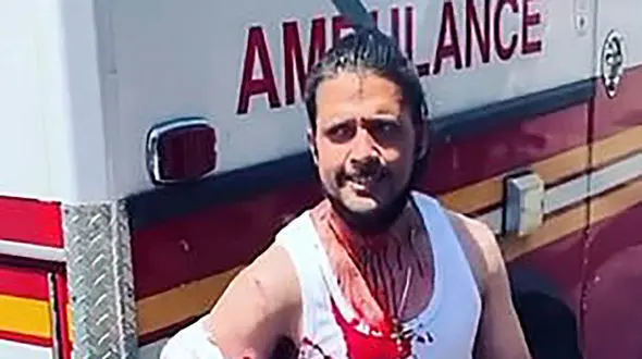 گیرکردن وحشتناک چاقوی یک زن خشن در جمجمه یک مرد + فیلم