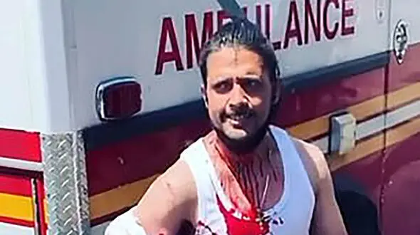 گیرکردن وحشتناک چاقوی یک زن خشن در جمجمه یک مرد + فیلم