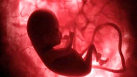 ژنتیک دلیل 80 درصد سقط جنین ها / کاهش فرزند آوری به دلیل مسائل اقتصادی و اجتماعی 