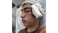 معلم با دسته صندلی به سر و صورت دانش آموز کوبید / آموزش و پرورش بم پیگیر برخورد با متخلفان است
