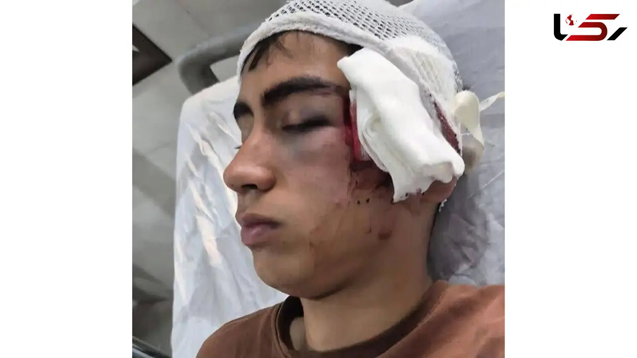معلم با دسته صندلی به سر و صورت دانش آموز کوبید / آموزش و پرورش بم پیگیر برخورد با متخلفان است