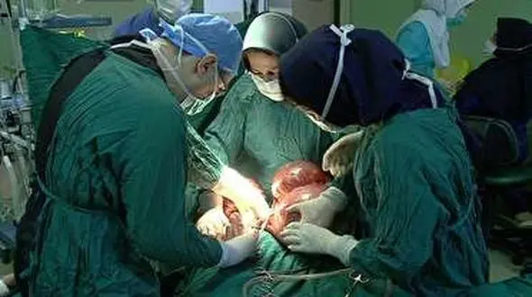 خارج کردن توده 12 کیلوگرمی از شکم پیرزن 87 ساله ای مراغه ای