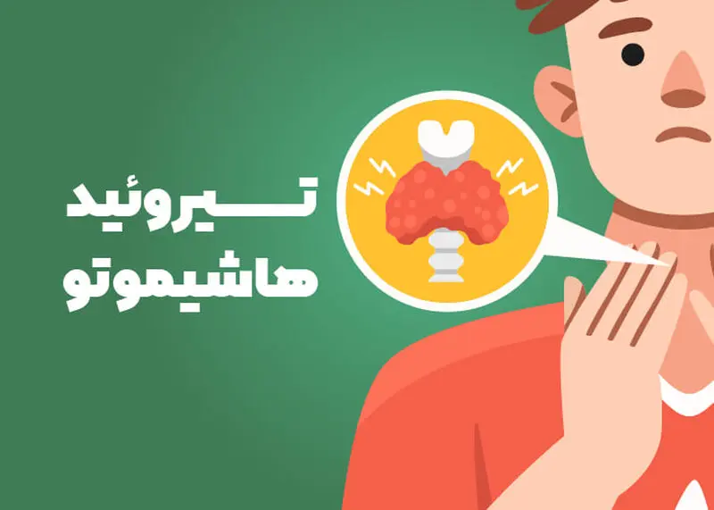 هاشیموتو