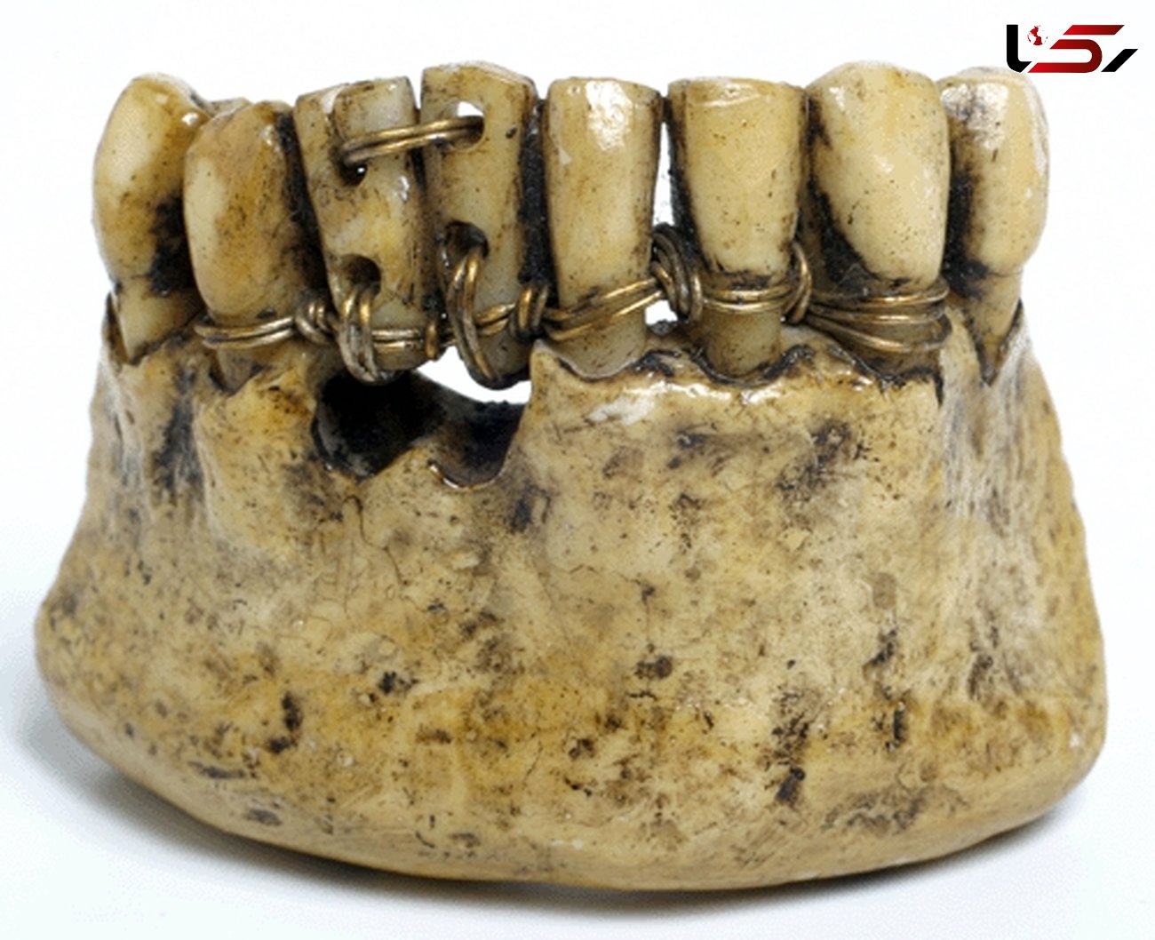 سیم کشی دندان مردگان در مصر باستان! + عکس
