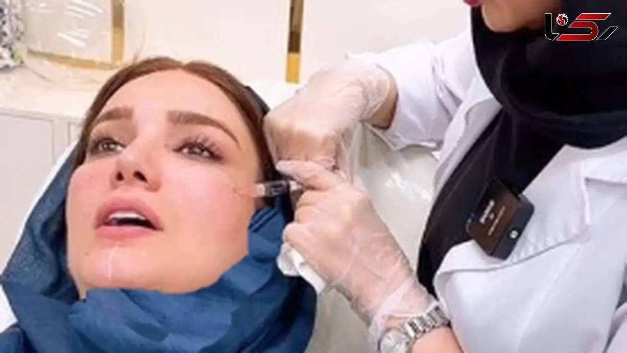 فیلم /  متین ستوده عروس خوش قدو بالا در حال تزریق ژل و انجام کارهای زیبایی  روی صورتش / برای عروسی حسابی پوستش آماده بود!