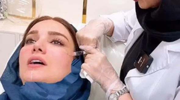 فیلم /  متین ستوده عروس خوش قدو بالا در حال تزریق ژل و انجام کارهای زیبایی  روی صورتش / برای عروسی حسابی پوستش آماده بود!
