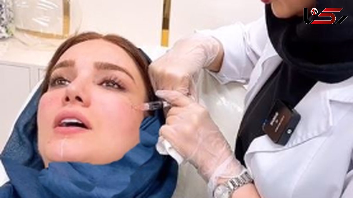فیلم /  متین ستوده عروس خوش قدو بالا در حال تزریق ژل و انجام کارهای زیبایی  روی صورتش / برای عروسی حسابی پوستش آماده بود!