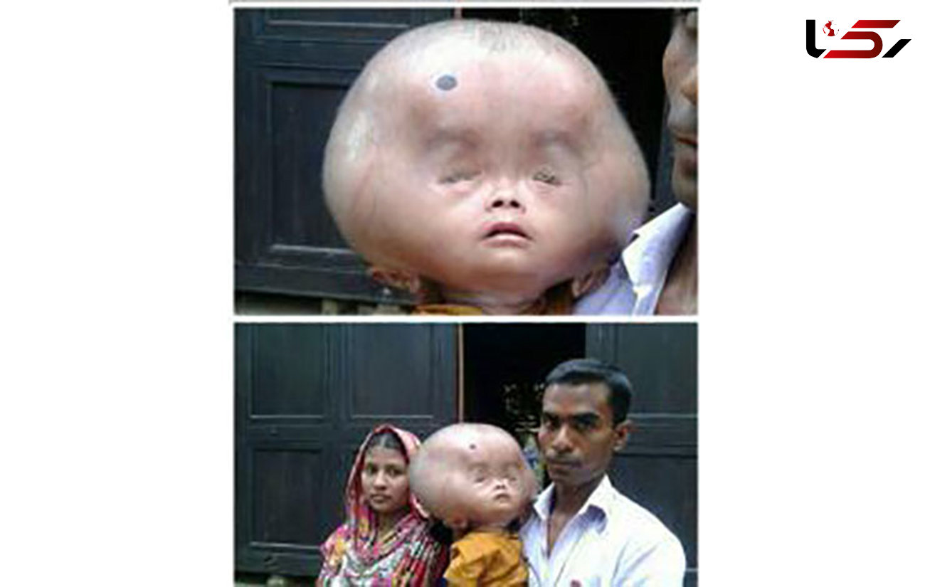 نوزادی با چهره ای عجیب + عکس
