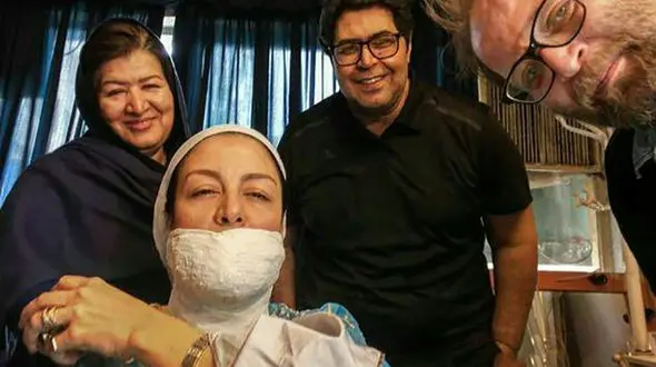 مریلا زارعی با صورت گچ گرفته +عکس