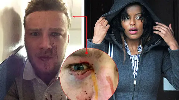 دختر دانشجو جواب توهین پسر جوان را با چاقو داد / ببینید چه بر سر این پسر آمده است+عکس