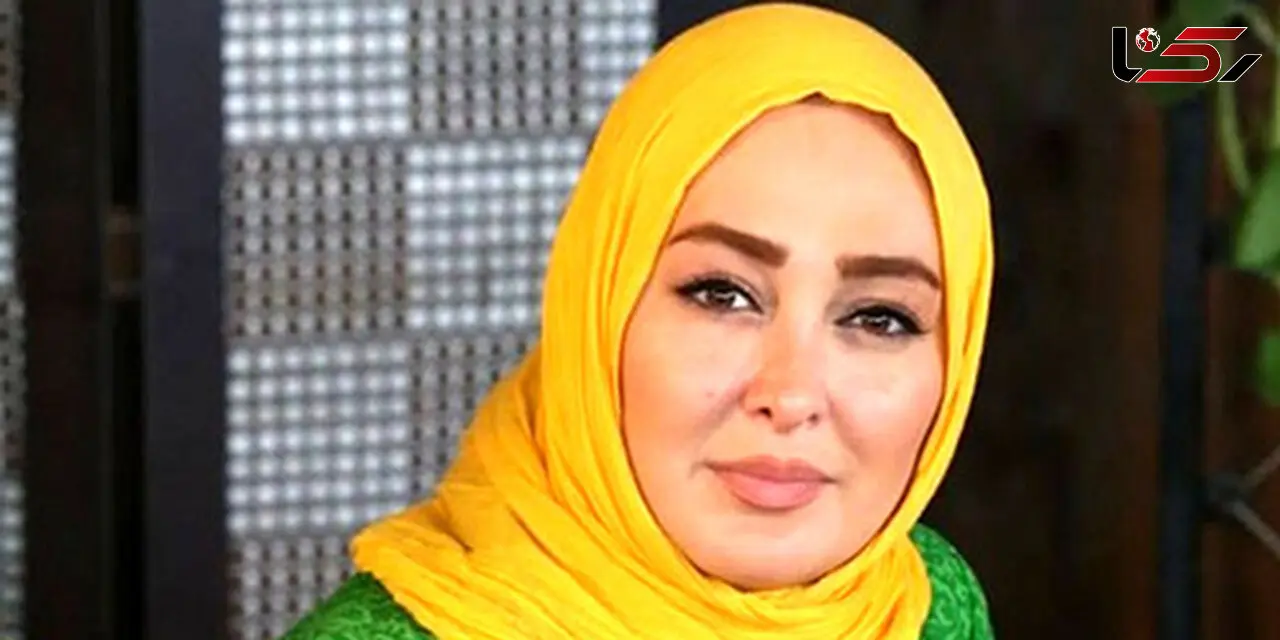 زیرو رو شدن چهره الهام حمیدی / خانم بازیگر با عمل زیبایی پلنگ شد / فقط مقایسه کنید