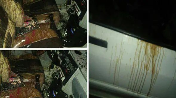 مرگ مرد جوانی که در زابل مورد اسیدپاشی قرار گرفته بود+عکس