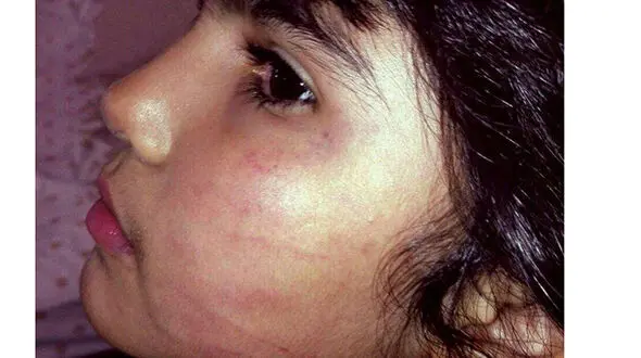 اقدام هولناک یک  دندانپزشک با دختر بچه 6 ساله+عکس