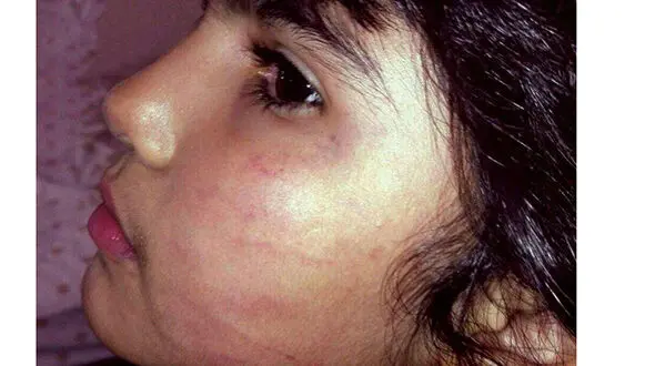 اقدام هولناک یک  دندانپزشک با دختر بچه 6 ساله+عکس