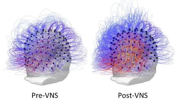 امید تازه برای هشیاری بیمارانی که در کما هستند