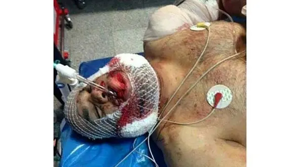 عاملان حمله به فریدون قنبری دستگیرشدند + عکس