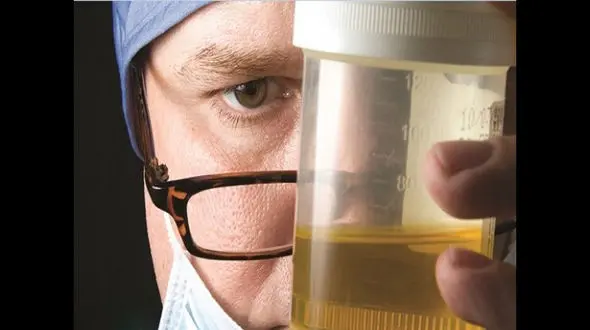 شایع‌ترین علت تغییر رنگ ادرار چیست؟ 