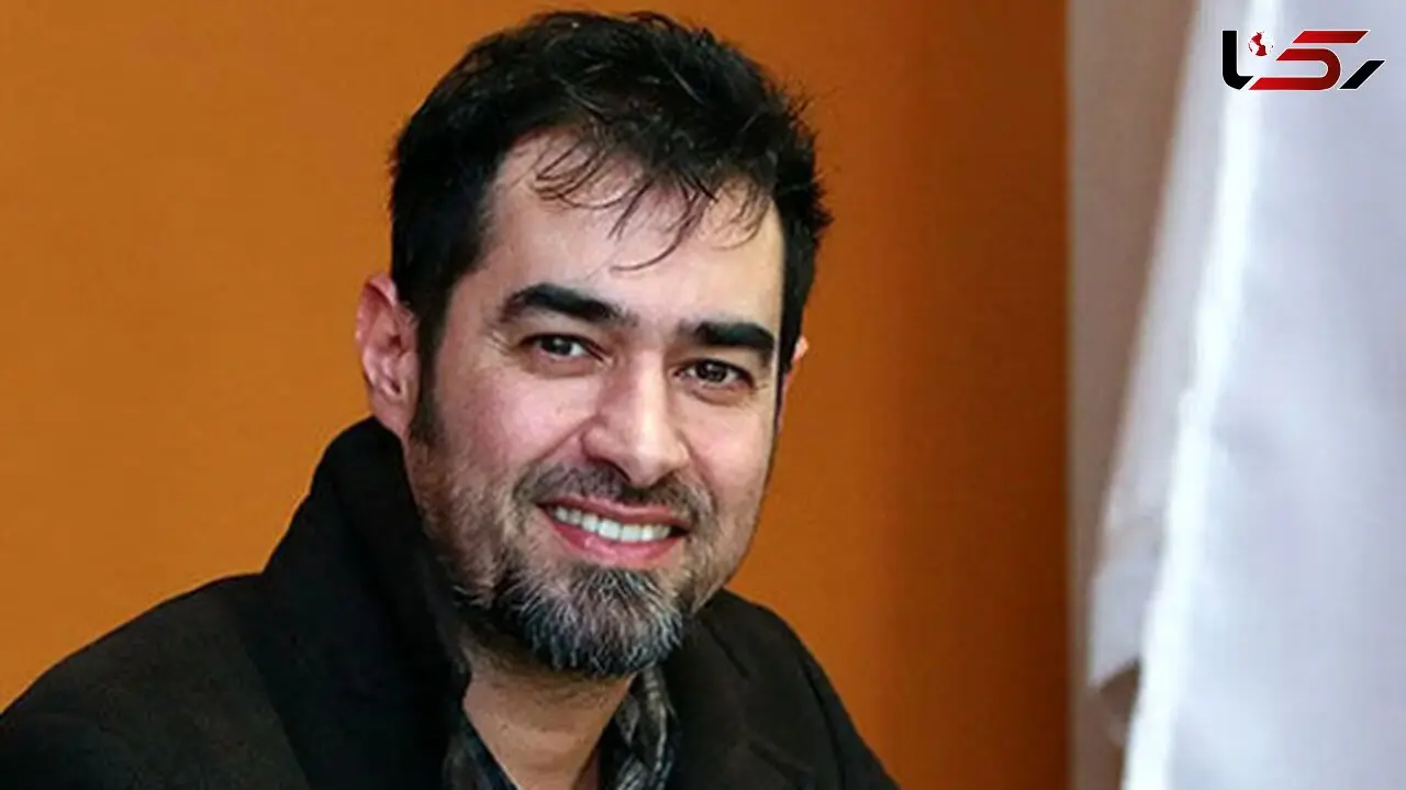 وقتی شهاب حسینی کاملا ناگهانی کچل شده است!