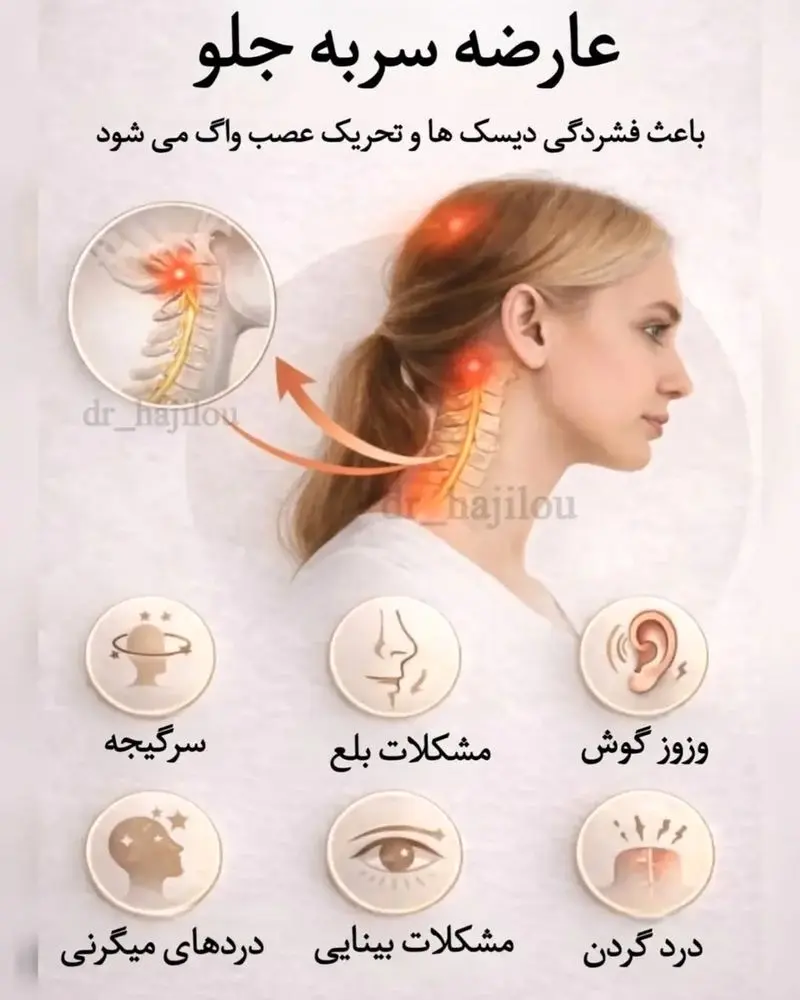 سر به جلو