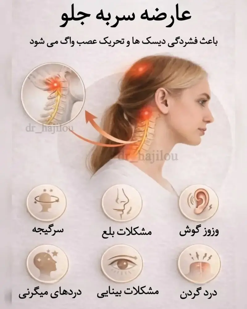 سر به جلو