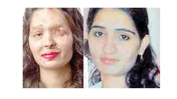 دخترقربانی اسید پاشی در هفته «مد» نیویورک